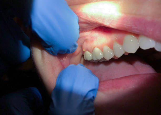 Best Cracked Tooth Emergency Dentist  in Maryland City, MD